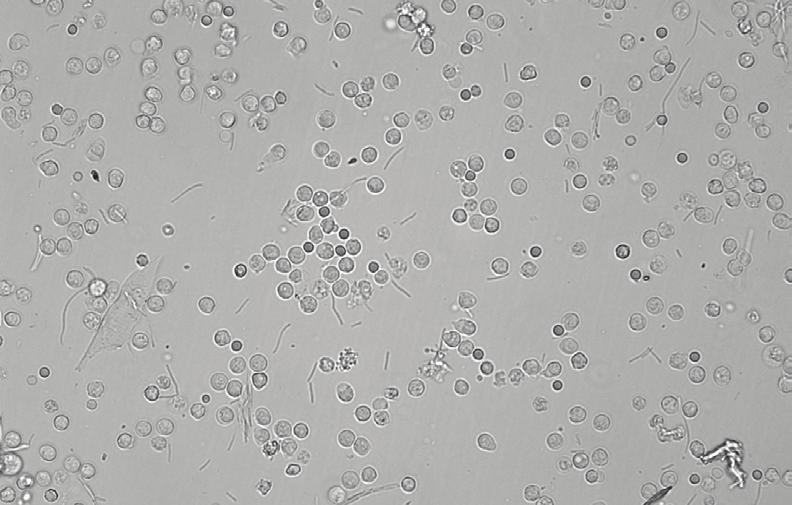 consigli sui test diagnostici, o assistenza riguardante gli esiti clinici dei pazienti.