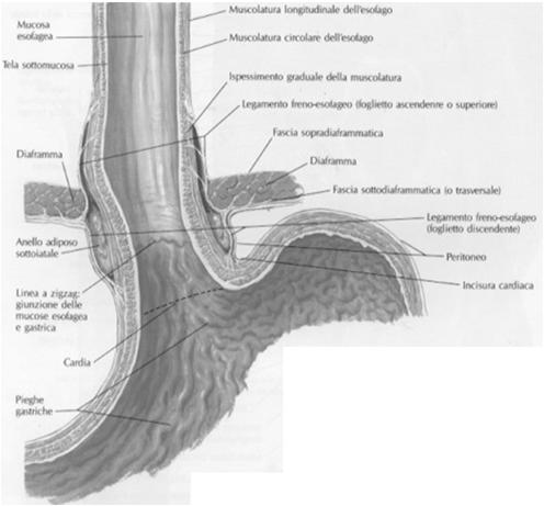 Giunzione esofago gastrica OBIETTIVI TERAPIA CHIRURGICA ACCENTUAZIONE O RICOSTRUZIONE ANGOLO DI HIS INCREMENTARE LUNGHEZZA ESOFAGO ADDOMINALE