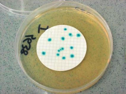 Metodi di analisi microbiologiche Francesca Borney approfondimento Le determinazioni analitiche di tipo microbiologico sono effettuate dall Area Microbiologia del Laboratorio dell ARPA.