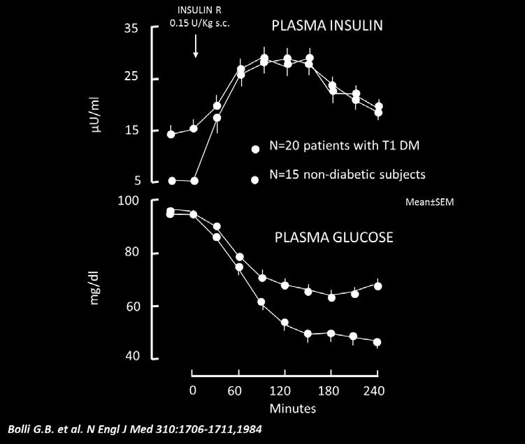 IPOGLICEMIA CAUSE - Iperinsulinemia