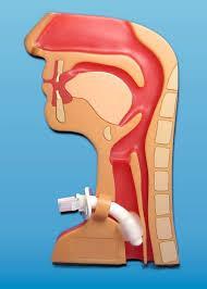 STATO DELL ARTE DELLA TECNOLOGIA TRACHETOMIA Procedura chirurgica che consiste in un apertura lineare della trachea finalizzata a posizionare una cannula che permetta la ventilazione, garantendo una