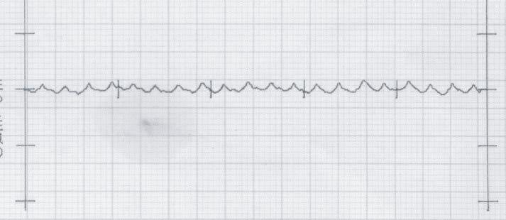 .(H) (HC),000min - (7m/min) Avnzmento 0,00mm/min (0.mm/dente) 0.