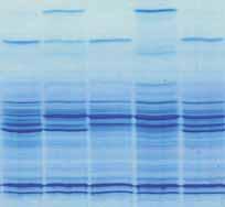 APPROFONDIMENTO Variabilità delle principali lattoproteine FIGURA A - Isoelettrofocalizzazione (IEF) di 5 campioni individuali di latte Alfa S1 -CN B Beta-CN A 2 Beta-LG A 2 Beta-CN A 1 Beta-LG B