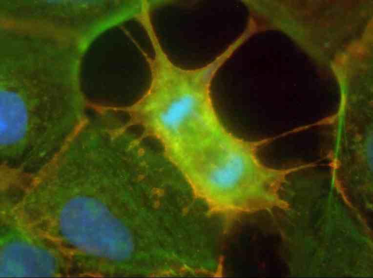 Citocinesi I punti focali di adesione sono importanti per generare le forze