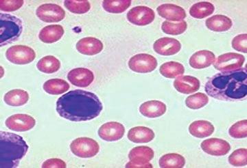 I linfociti sono i costituenti principali del sistema immunitario che costituisce una difesa contro l attacco di microrganismi patogeni (virus, batteri, funghi).