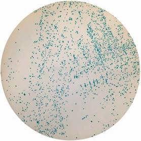 ENTEROBACTER SAKAZAKII ENTEROBACTER SAKAZAKII CHROMOGENIC AGAR (ESIA) (ISO 22964: 2006) Terreno selettivo cromogenico per il conteggio e l identificazione di Enterobacter Sakazakii.