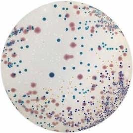 7 TERRENI CROMOGENICI / CLINICO Terreni di coltura Cromogenici disidratati, pronti in flacone e piastre petri per l analisi di campioni clinici. (*) Prodotto disponibile con ordine minimo.