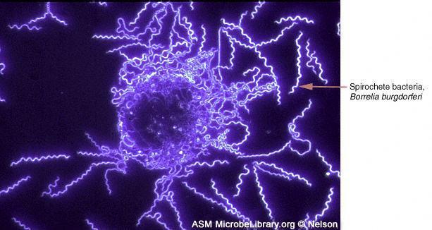 Esame microscopico ( a fresco ) Si esegue soprattutto per la ricerca di