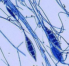 Microsporum: conidi