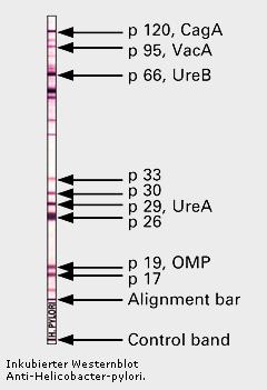 anticorpo secondario (anti-anticorpo primario) marcato con un enzima (perossidasi) La formazione di immunocomplessi (e quindi la