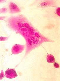 cellule multinucleate o sincizi HSV Linee cellulari: HEK, HEP-2, KB, NCIH292, Vero