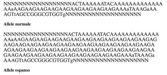 Patologie da espansione di triplette La patologia ha alla base un allele mutato «espanso»: ripetizioni consecutive, in numero variabile e