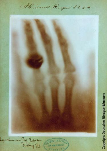 perché nella fisica questa lettera si usa per indicare qualcosa di «sconosciuto». Nella lingua inglese questi raggi sono ancora oggi chiamati «x rays» (inglese ray = raggio).