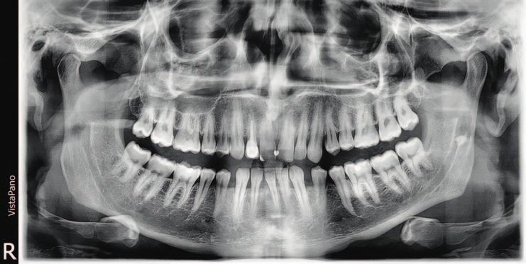 Composte assieme, forniscono un immagine panoramica che si allinea all effettiva anatomia del paziente.