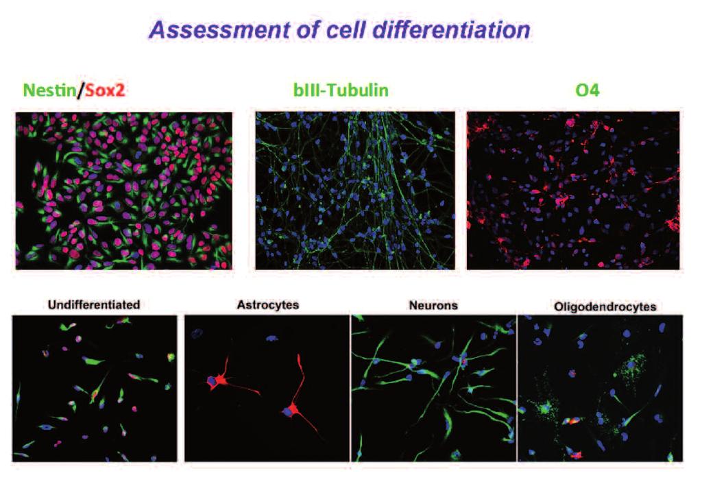 Immunopositività per Nestina e SOX-2 (cellule indifferenziate), biii Tubulina (differenziamento neuronale) e O4 (differenziamento)