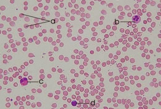 Il SANGUE Il sangue e la linfa sono anch essi dei tessuti connettivi nei quali però la sostanza intercellulare è liquida.