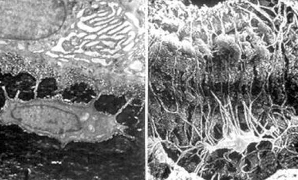 Osso: struttura Le cellule contenute nelle lamelle ossee sono di tre tipi: OSTEOBLASTI OSTEOCITI OSTEOCLASTI OSTEOCITI: una volta costituita e calcificata la matrice, molti osteoblasti