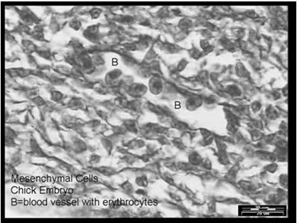 (left panels) expressing E-cadherin and a cortical actin ring but no mesenchymal markers (vimentin).