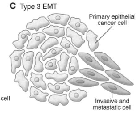 (C) Infine, l epitelio secondario assocato a molti organi può trasformarsi in cellule tumorali che più tardi subiscono le EMTs che permettono loro ei invadere e disseminarsi metastaticamente: tipo 3