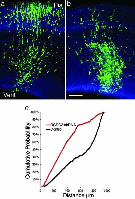 Il gene DCDC2 e la migrazione neuronale Negli embrioni di ratti il gene DCDC2