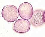 parte superiore. I fiori sono ermafroditi e il frutto una samara. Diffuse fino a 7-12 m s.l.m. allergenico Fig.