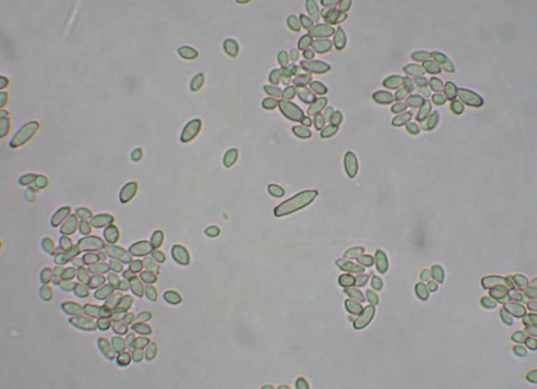 Cladosporium Fig. 42 Spore di Cladosporium Fig. 43 Granoturco infestato da Cladosporium Il genere Cladosporium è una muffa che cresce su diversi substrati vegetali.