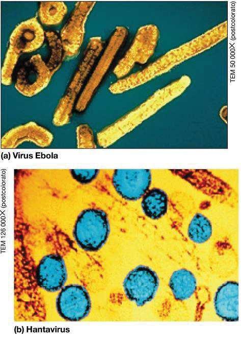 L'ebola è un virus ad RNA appartenente alla