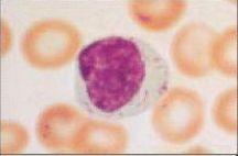 granular lymphocytes
