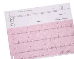 Materiali di consumo per sistemi ecografi ci e per Carta per elettrocardiografi Carta di registrazione 989803137011 Carta termica StressView.