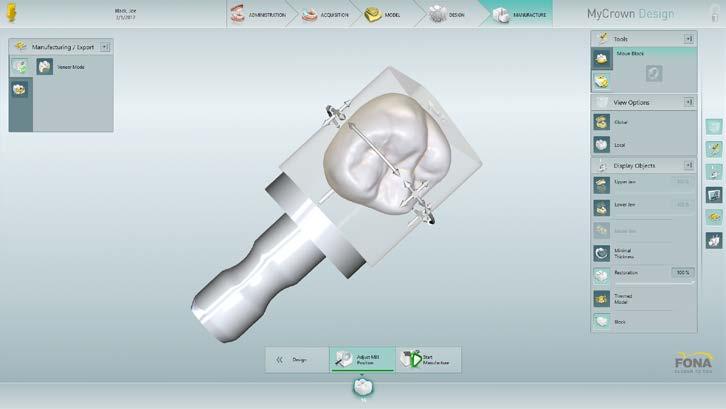 BENEFICI MYCROWN SCAN E MYCROWN DESIGN Il sistema Mycrown CAD/CAM garantisce un flusso di lavoro guidato e senza interruzioni a partire dall acquisizione per passare al design e infine per la