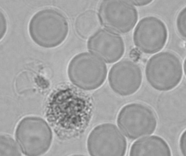 Combattere l infezione virale - 3 a linea di difesa: Sistema immunitario acquisito: linfociti T e B e anticorpi. Molto specifico ed efficace. 8-10 giorni per essere efficiente.