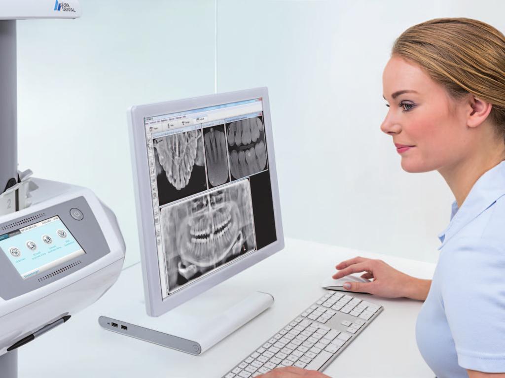 Nuova dimensione in radiografia strada futura degli scanner per film ai fosfori Il top del riconoscimento dei dettagli per il supporto diagnostico I filtri digitali per una diagnosi sicura: il