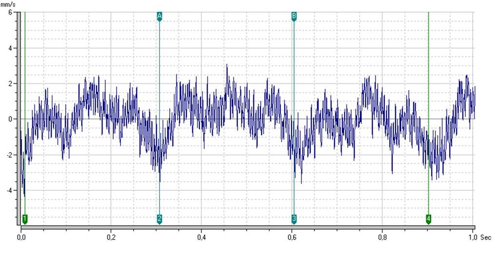 Fig. 5.28 Configurazione C: Forma d onda Il segnale risulta molto più pulito: la componente ad alta frequenza ha ampiezza molto minore.