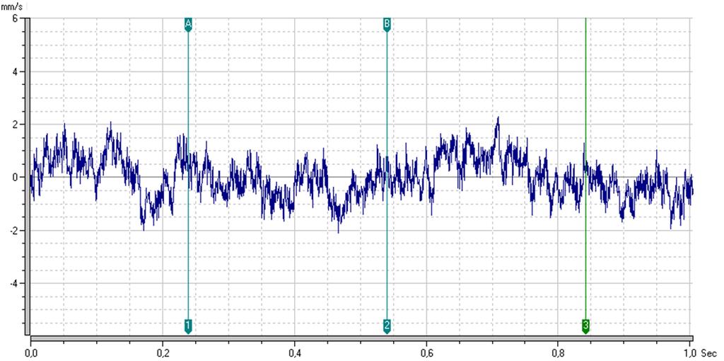5.5.3 Configurazione D: Forma d onda Con riferimento alla forma d onda, si rileva una forma molto simile a quella relativa alla configurazione solo raddrizzata. Fig. 5.