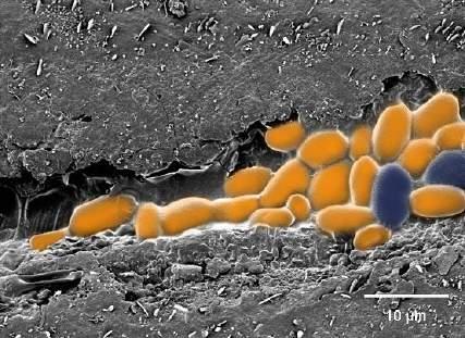 Microlesioni sulla superfice degli acini rappresentano la naturale via di penetrazione del patogeno.