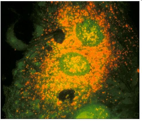 Microscopia a fluorescenza Studio morfologia nucleare: COLORAZIONE CON ARANCIO DI ACRIDINA L arancio di