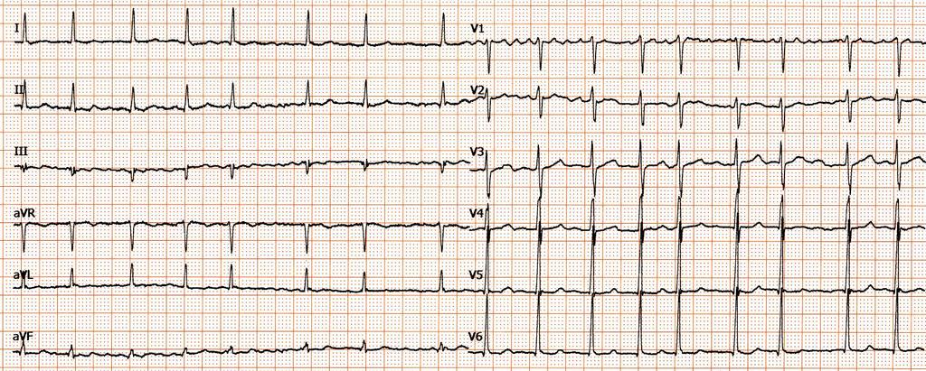 ! Si è rivolta al mdb per cardiopalmo da 4-5