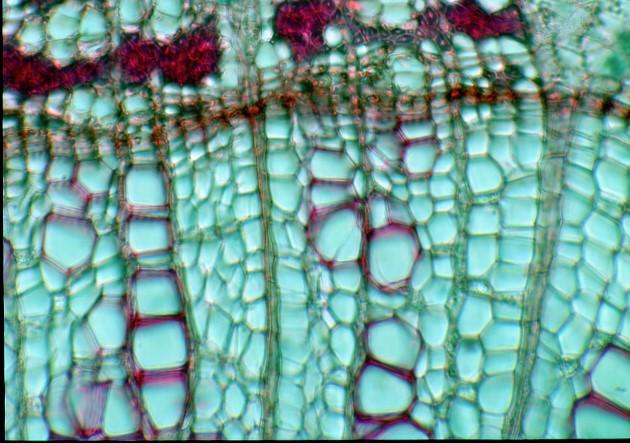 parenchima di dilatazione fibre floematiche cambio