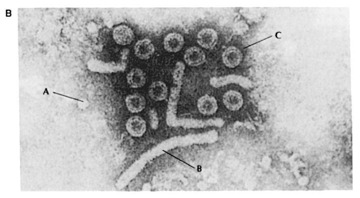 Caratteristiche VIRUS DELL EPATITE B Capside icosaedrico, con envelope. DNA circolare a doppia elica, incompleto (solo l emielica (-) è completa).