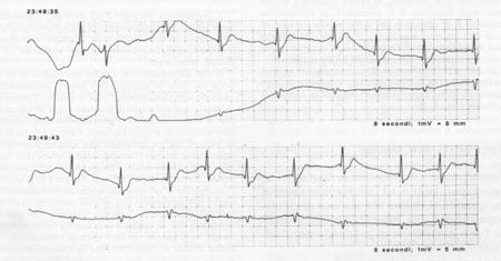 ECG DINAMICO