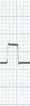 Alcune notizie preliminari L ECG