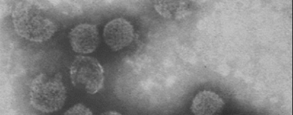 Eziologia Infectious Bursal Disease Virus (IBDV) Fam. Birnaviridae, Gen.