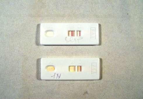 TM -SALIVA TEST CONFERMATIVO PER IL LIQUIDO SEMINALE Test per la rilevazione del PSA