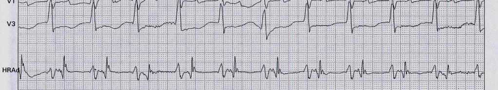 Terapia Pazienti in scompenso Cattive condizioni