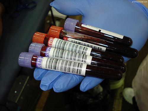 Test Tubes with Blood, Author: biologycorner (CC BY-NC 2.