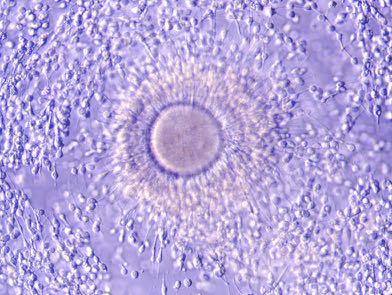 5 x 1-6 µm emivita-: 3-5 gg 2 membrane: M.