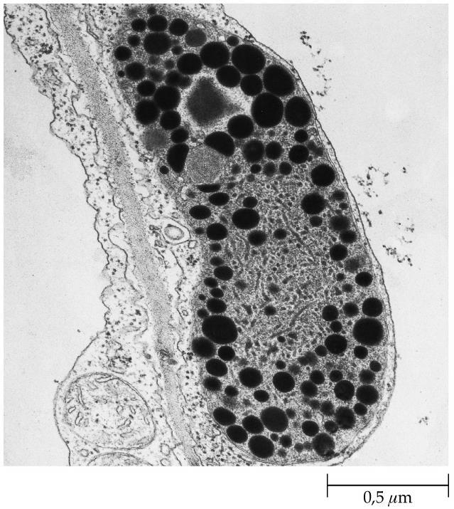 Possono avere membrane interne ma mancano di un vero e proprio sistema tilacoidale.la conversione cloroplasto-cromoplasto comporta la degradazione delle clorofille.