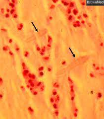 Altro esempio di proteine accumulate nei proteinoplasti sono le proteine P delle cellule del floema.