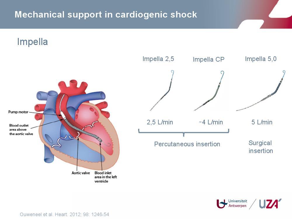 IMPELLA