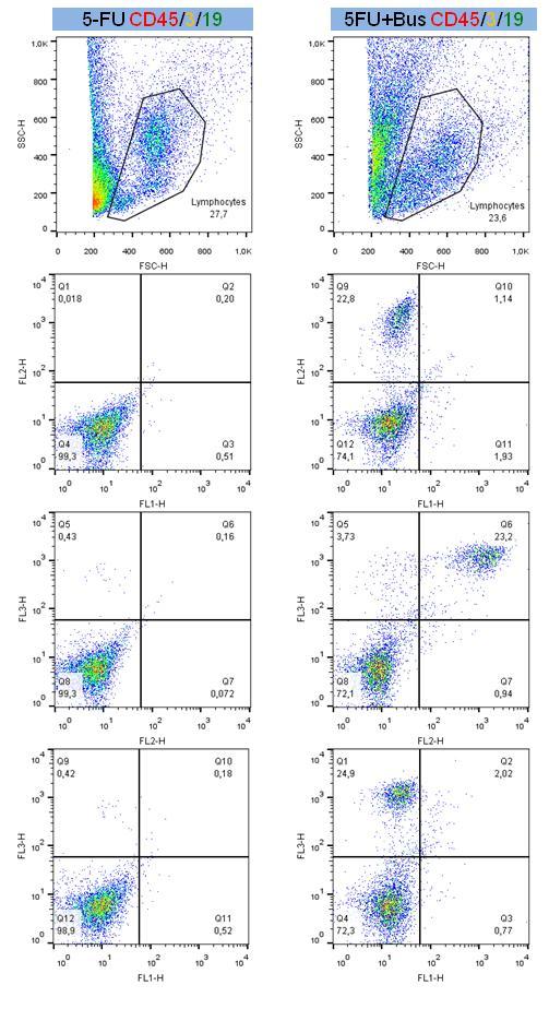 Fig. 4c 5FU CD45/3/19 Analisi Immunofenotipiche (25 weeks) su midollo osseo di un topo trattato con 5- Fluorouracile in cui sono state iniettate cellule umane CD34+ hanno mostrato una positività